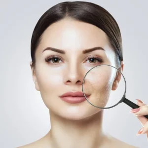 چگونه پوست صورت خود را بشناسیم و چه اهمیتی دارد؟