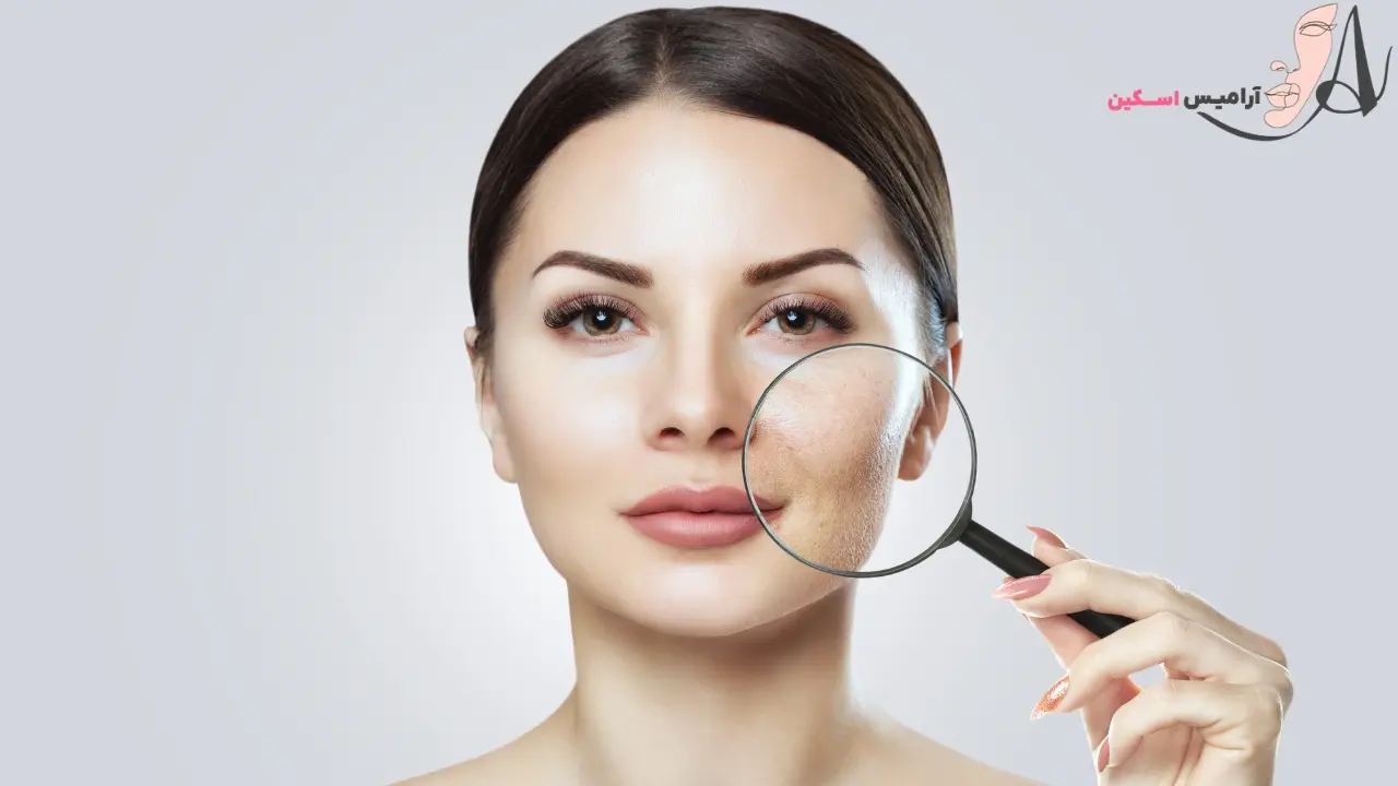 چگونه پوست صورت خود را بشناسیم و چه اهمیتی دارد؟